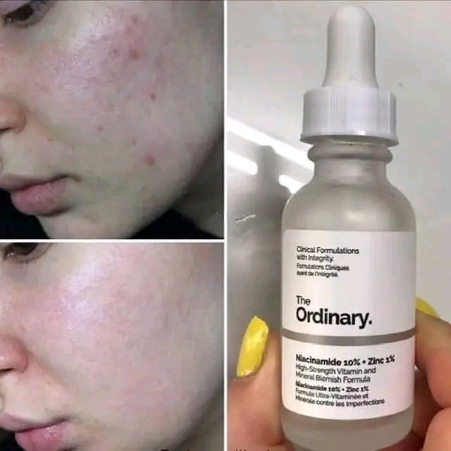 Skincare Serums The Ordinary Niacinamide 10% + Zinc 1%Niacinamide 10% + Zinc 1